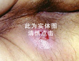 点击咨询