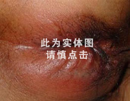 点击咨询
