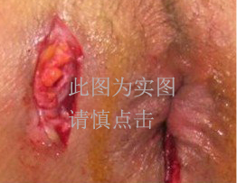 点击咨询