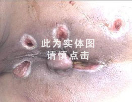 点击咨询